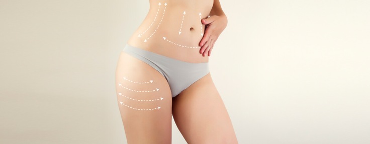 Here’s Top 5 Benefits of Liposuction
